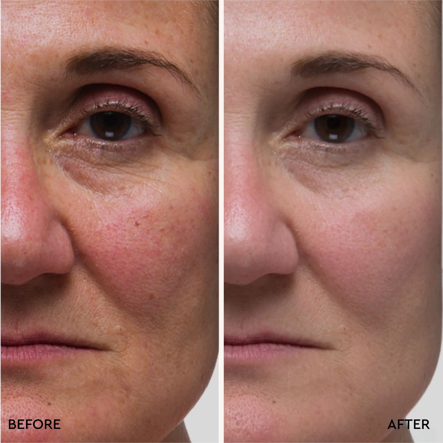 Deep Moisture Mask